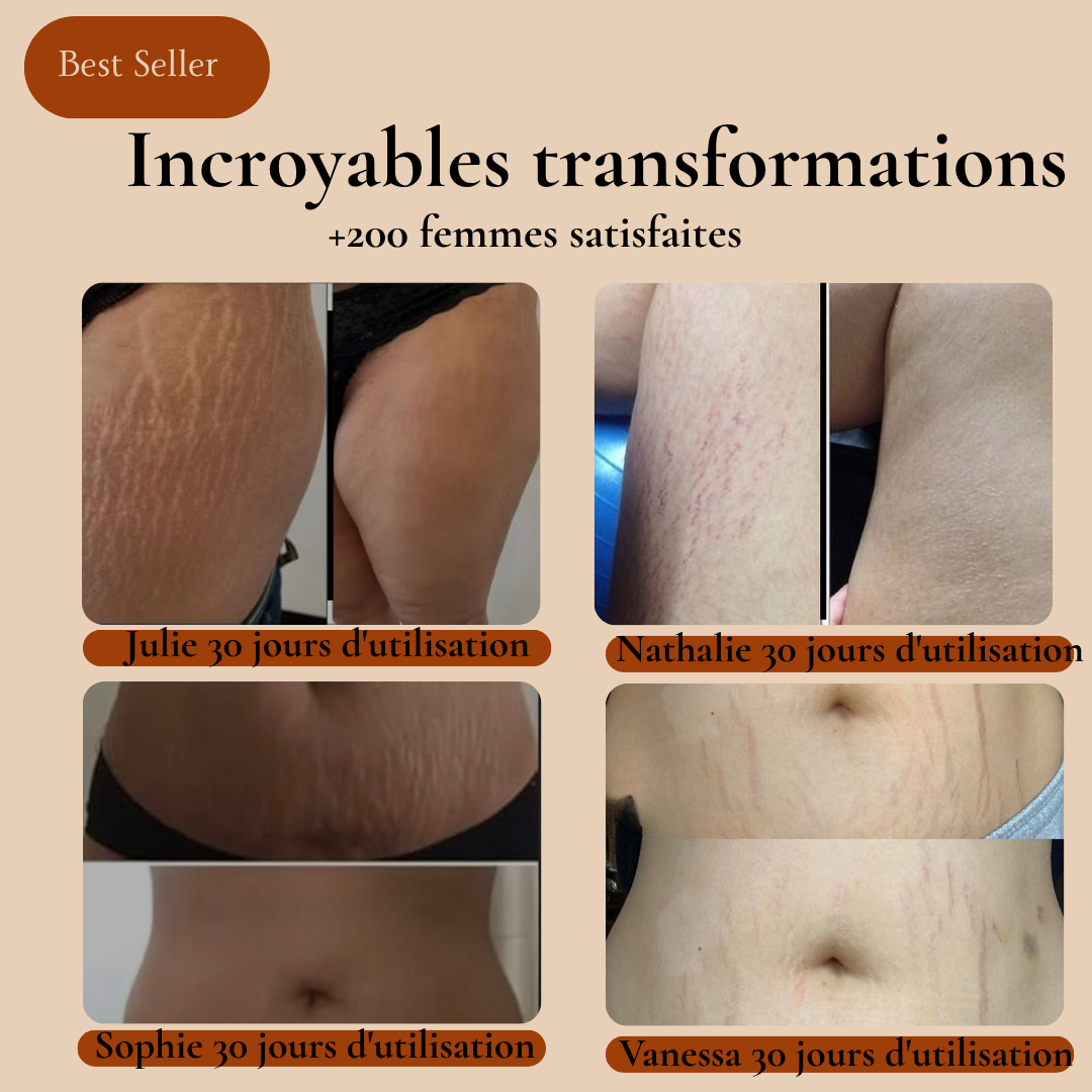 Savon noir - anti vergetures